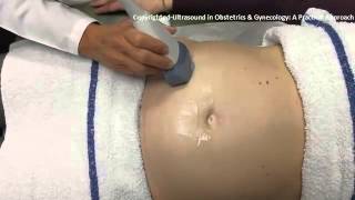 Ultrasound in Obstetrics amp Gynecology A Practical Approach  Clip 104 [upl. by Bogusz38]