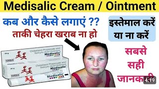 medisalic cream review in hindi l madisalic cream ke side effects medisalic cream for pigmentation [upl. by Nive]