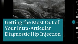 10 Tips for Getting the Most Out of Your IntraArticular Diagnostic Hip Injection [upl. by Alix]