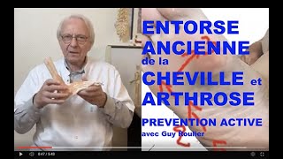 Vidéo Entorse de cheville ancienne ou récidivante  attention à larthrose  par Guy Roulier [upl. by Anna]