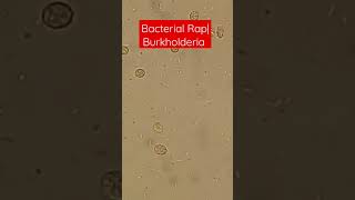 Bacterial Motility  Burkholderia in Rap Move [upl. by Ihsir]