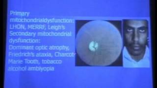 Hereditary and toxic nutritional optic neuropathies [upl. by Chlores]