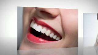 Teeth Whitening Foam [upl. by Vachell]