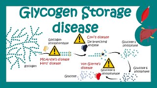 Glycogen Storage Diseases  GSD  Which glycogen storage disorder is most common  pathology of GSD [upl. by Tracey]