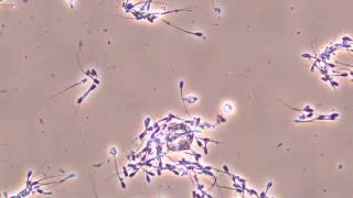 Moving pig sperm observed by biological [upl. by Prissie]