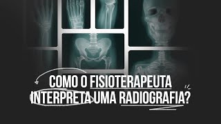 Como o fisioterapeuta interpreta uma RADIOGRAFIA [upl. by Enelrahc]