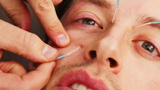 The Try Guys Try Acupuncture [upl. by Hausmann]