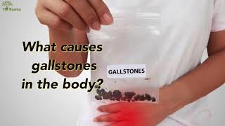 GALLBLADDER treatment in Ayurveda [upl. by Ahselat]