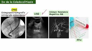 Anatomía del Colédoco [upl. by Tannen]