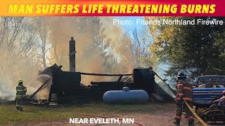 Rural Eveleth MN Man Suffers Life Threatening Burns [upl. by Zerelda503]