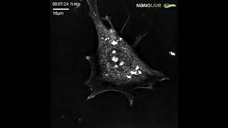 Mitochondrial changes induced by Antimycin A [upl. by Lorens]