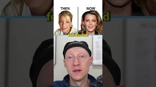 Should Celebrities Admit To Plastic Surgery [upl. by Anohs543]