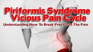 Piriformis Syndrome Causes amp How Pain Increases Via This Vicious Cycle [upl. by Leahcimauhsoj]