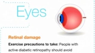 Diabetes and Exercise I have diabetic retinopathy What precautions should I take while exercising [upl. by Einnim]