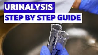 HOW TO DO URINALYSIS MEDICAL LABORATORY SCIENCE [upl. by Lita405]