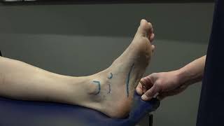 Foot and Ankle 2  Plantar Fascia and Spring Ligament Palpation [upl. by Ivie]