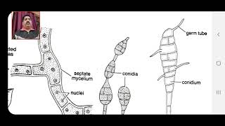 BSc 1st Exploring the Intriguing World of Alternaria Fungi [upl. by Aizirtap]