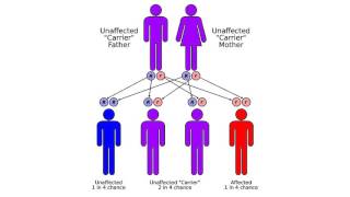 Congenital adrenal hyperplasia due to 11βhydroxylase deficiency [upl. by Ayokahs]