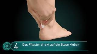 Wie wende ich Compeed Blasenpflaster richtig an [upl. by Eloci]