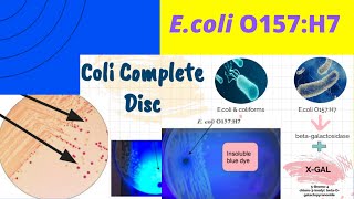 Ecoli O157H7 A Foodborne pathogenEnrichment amp IsolationEEBSMAC TSYEEMB and Coli complete Disc [upl. by Max181]