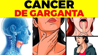 10 señales iniciales de cáncer de garganta [upl. by Etselec]