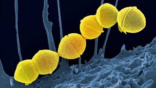 Overview and Introduction to Streptococcus Bacteria Microbiology [upl. by Noinatrad]