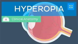 Farsightedness Hyperopia Definition causes symptoms diagnosis and treatment  Kenhub [upl. by Alor]