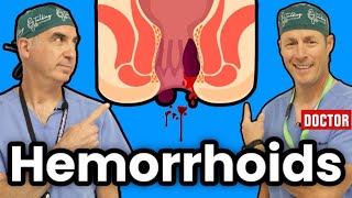 How To Get Rid Of Hemorrhoids [upl. by Htedirem]