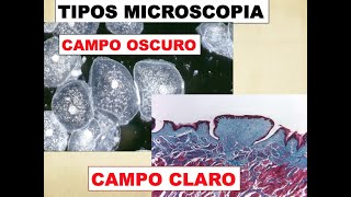 TIPOS DE MICROSCOPIA  CAMPO CLARO Y CAMPO OSCURO [upl. by Nich327]