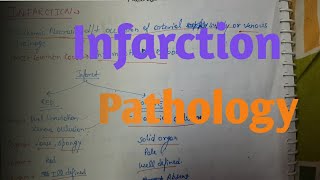 Infarction Pathology [upl. by Jentoft]