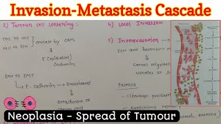 InvasionMetastasis Cascade  Spread of Tumour  Neoplasia [upl. by Ginder]