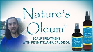 Natures Oleum Scalp Treatment with Pennsylvania Crude Oil [upl. by Inail]