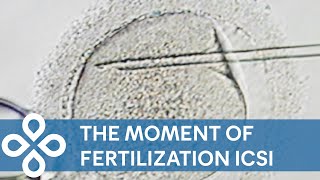 Fertilization of Sperm and Egg  ICSI Footage [upl. by Bouldon319]