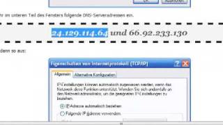 Tutorial DNS Einstellung ändern bei Vista [upl. by Iorio]