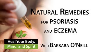 Home Remedies for Eczema and Psoriasis  Barbara ONeill 0713 [upl. by Hahseram]