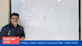 Neurological Localisation in Spinal Lesions  Spinal Lesions Localisation [upl. by Razal]