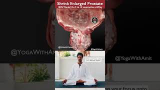 Shrink Enlarged Prostate shrinking enlargedprostate yogawithamit [upl. by Aicekat441]