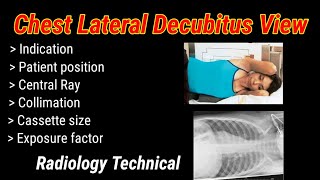 Chest lateral Decubitus View  Right amp Left decubitus  By BL Kumawat [upl. by Ayhtak]