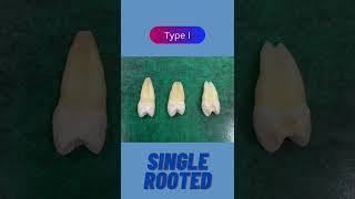 Maxillary 1st Premolar Root Variations [upl. by Ahsercel]