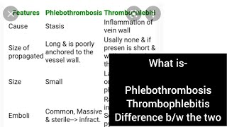 Phlebothrombosis Thrombophlebitis Pathology Second year mbbs [upl. by Hcone]