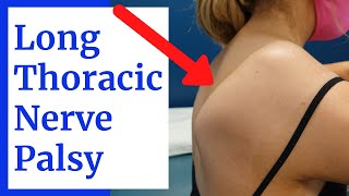 Long Thoracic Nerve Palsy Shoulder Blade Winging Evaluation [upl. by Lalla247]