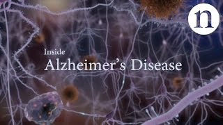 Inside Alzheimer’s disease [upl. by Aiket855]