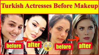 Turkish actresses without makeup 😮  you have to see this shocking video [upl. by Banky]