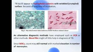 Lec19 diagnostic microbiology بكتريا تشخيصية  الجزء الثاني لبكتريا الجهاز التنفسي  المرحلة الرابعة [upl. by Delos]