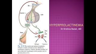 Hyperprolactinemia [upl. by Quintie]