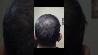 Power of Regenera Activa ie stem cell activation dlapp bigdawg hanumankind viralshort haircare [upl. by Jacobs306]