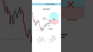 OPTION TRADING PSYCHOLOGY tradingview  Stock  Market  crypto  Trading  shorts [upl. by Adon]