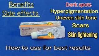 Skinoren cream  Skinoren cream before and after  Azelaic acid  honest review [upl. by Hunter]