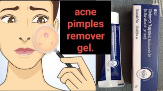 Clinmiskin gel ka use kaise karna hai  Acne pimples and pimples marks ko remove kaise Karen [upl. by Whitebook]