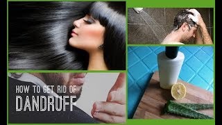 This Natural Aloe Vera Shampoo Recipe Relieved My Very Itchy Scalp IN JUST 1 WASH [upl. by Meid]